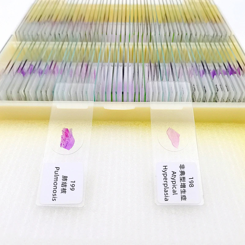 200 pz/set scuola di medicina insegnamento microscopio umano patologico preparati diapositive