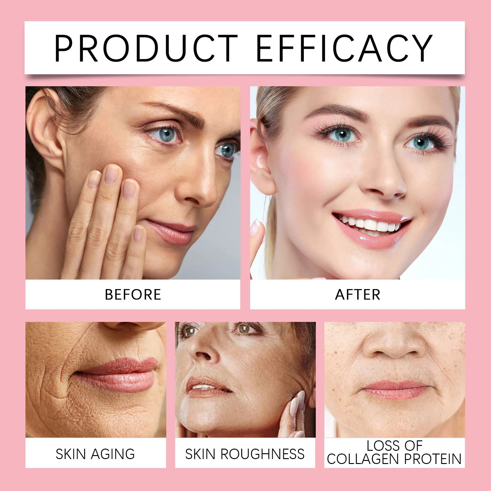 HOYGI Niacinamide hydratant sérum pour le visage estompe mélanine éclaircissante réduire les taches foncées même le teint de la peau rajeunissement soin Essence