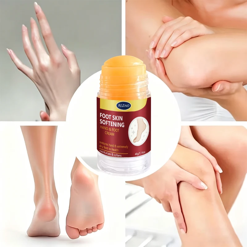 Rozino Hand and Foot Care Cream Stick, Prevents Wind Cracking, Resists Wind-Dryness, Moisturizes Dry Skin, Improves Signs of Dry, Rough, Wind-Chapped, and Peeling Skin, Provides Long-Lasting Hydration, Suitable for Hands, Heels, Ankles, and Elbows
