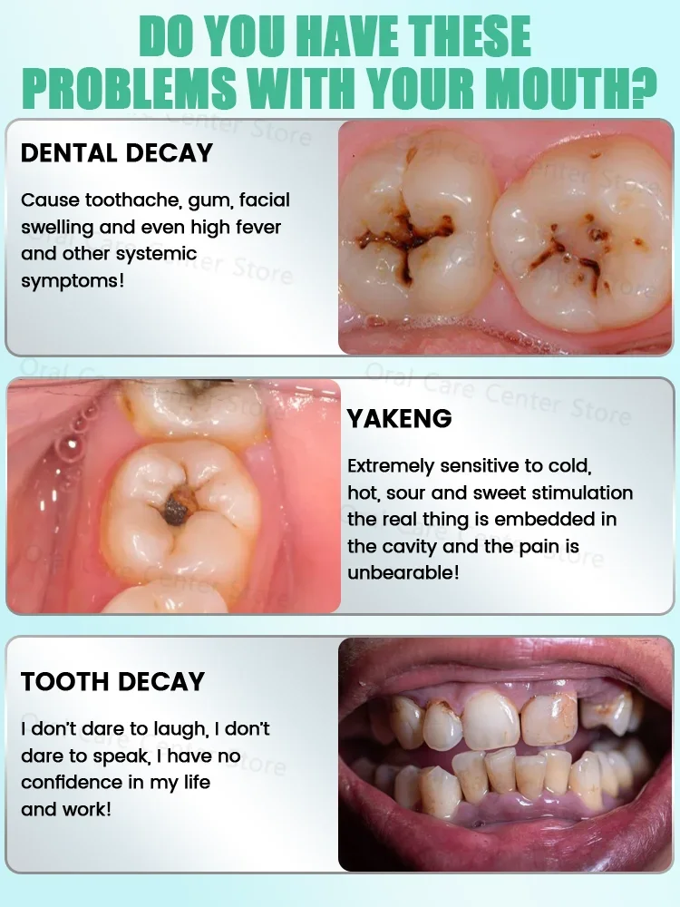 Hot selling product, 99% of buyers buy again,Teeth are getting better