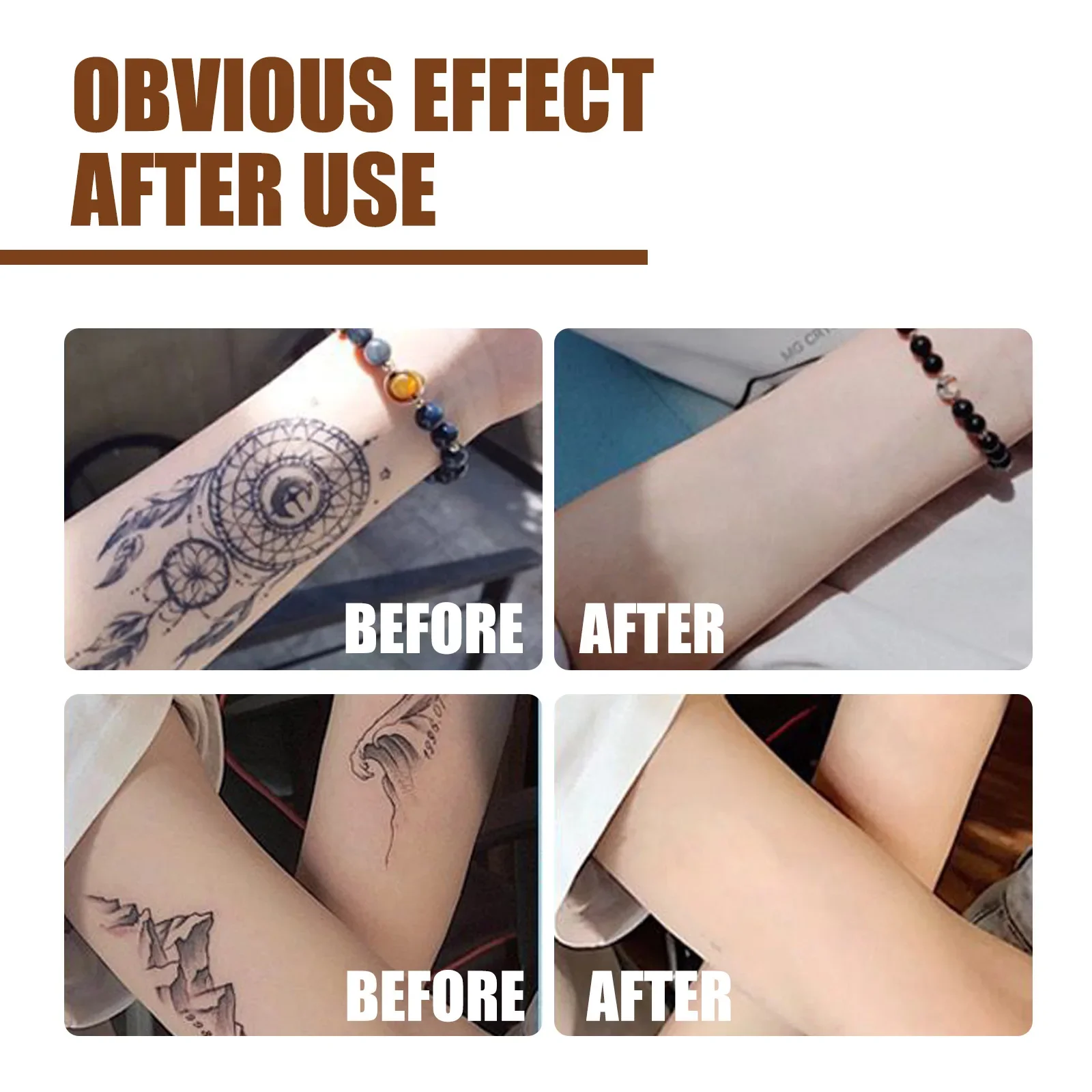Snelle Tattoo Verwijdering Serum Permanente Tattoo Remover Vloeistof Natuurlijke Pijnloze Lichaam Gezichtspigment Fading Tattoo Nazorg Crème