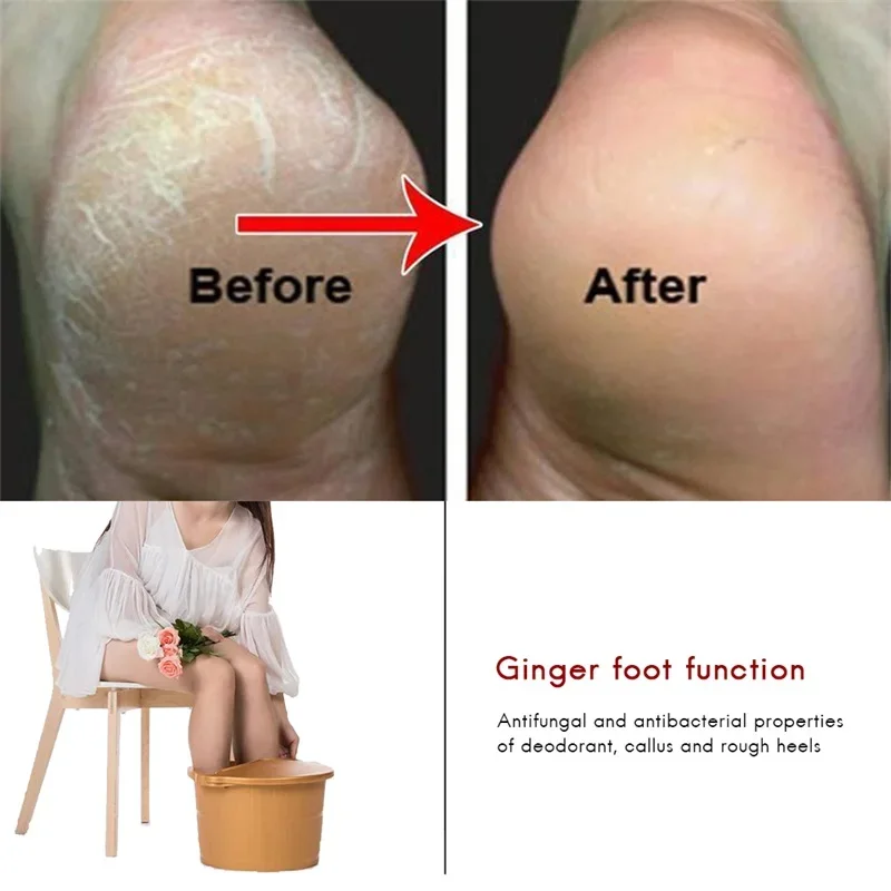 10pcs/bag Of Ginger Foot Effervescent Tablets Promote Metabolism Prevention Eliminate Fatigue Swelling Pain Foot Care Treatment