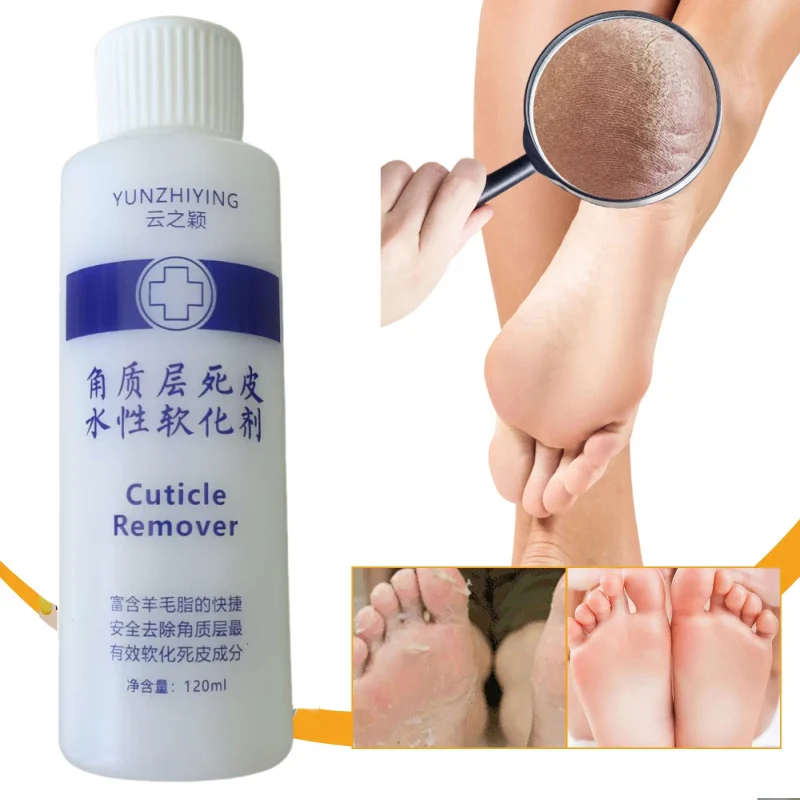 120ml pé cutícula esfoliante amaciante pé odor remover pele morta pé coceira peeling calos máscara de pé pedicure intensificador de unhas