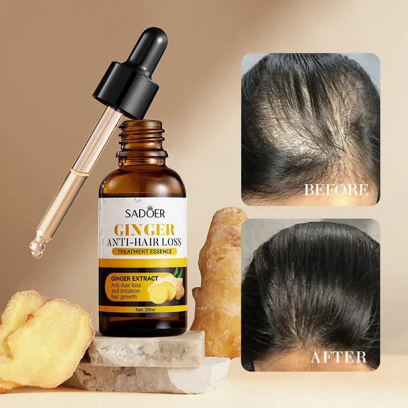 

SADOER Ginger Anti-Hair Loss Serum 30ml, Moisturizing Dry Curly Hair, Scalp Nourishing Essence, Cross-Border Wholesale