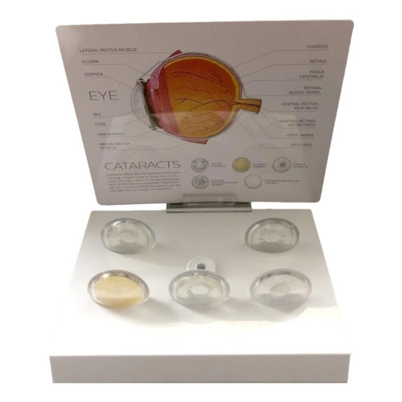 62KA نموذج تشريح مقلة العين المرضية الواقعية للتدريس، واستبحام الاستخدام التعليمي والعرض السريري