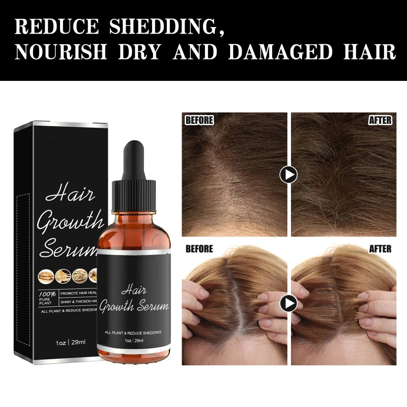 

Hair Growth Serum Moisturizing Strengthening Shine Improves The Appearance of Thinning Hair Nourishes The Scalp