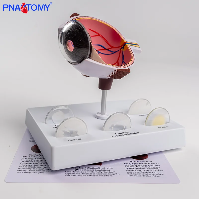 

Pathological Eye Model Eye Model Corneal Disease Eye Model Cataract Model Lens