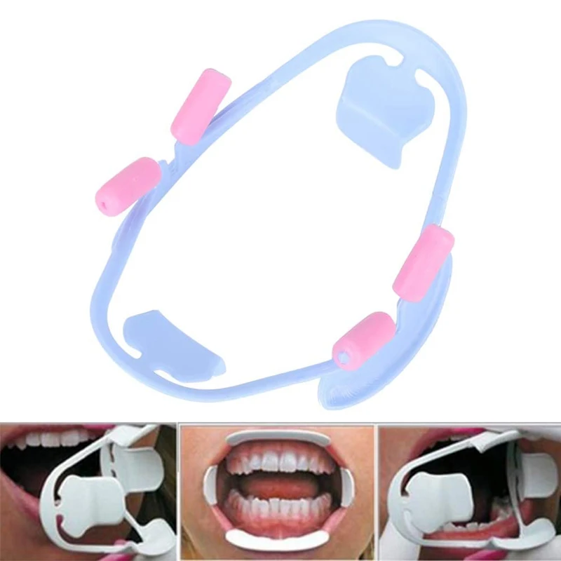 Dental 3D Oral Mouth Opener O Shape Cheek Lip Retractor Orthodontic Intraoral Expander Dentist Mouth Spreader Tool