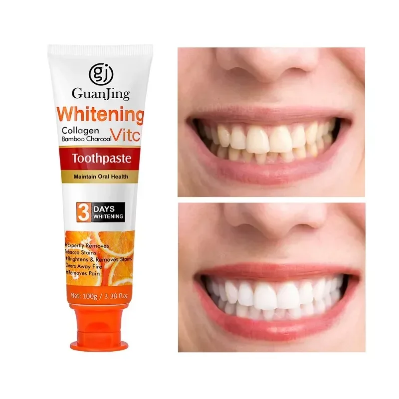 

치약 Vitamin C Toothpaste Teeth Whitening Oral Cleaning Remove Dental Stain Freshen Breath Maintain Oral Health Blanqueador Dental