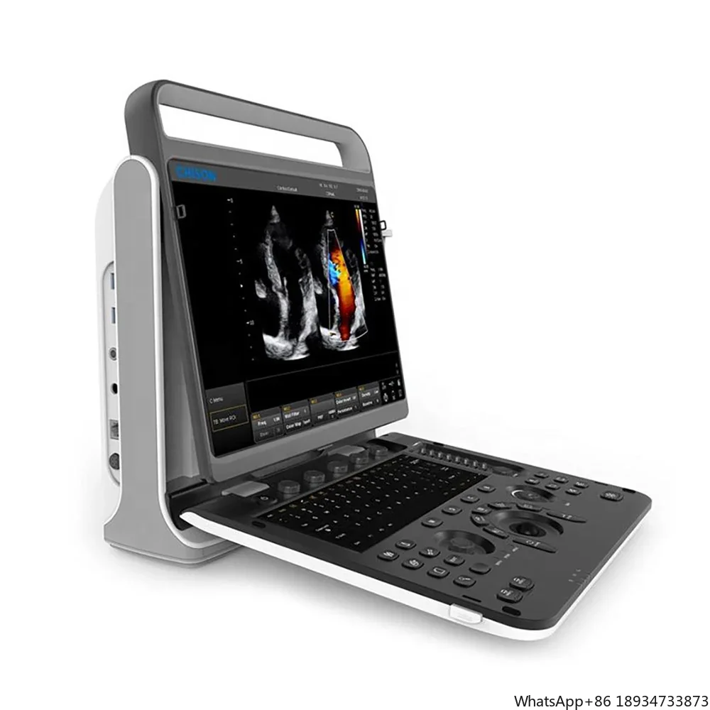 Laptop Ultrasound Machine Chison Ebit 60 4d Probe Siterite Color Doppler Medical Instrument Cardiac Ultrasound Machine