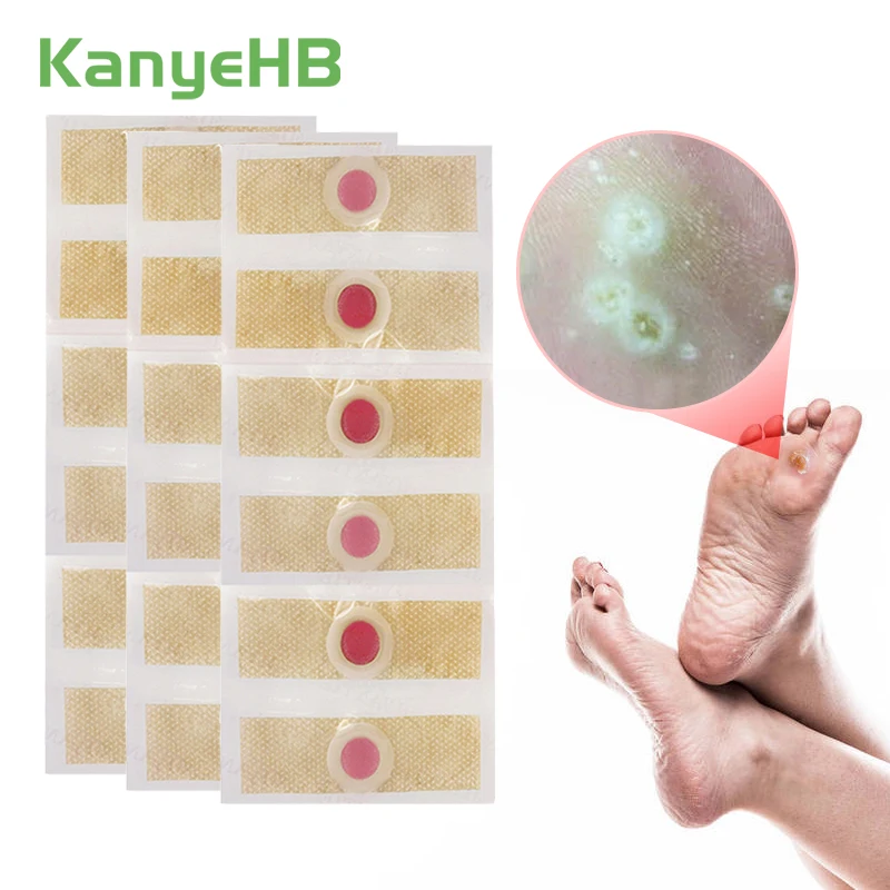 18pcs=3lots Corn Patch Feet Calluses Remove Callosity Detox Medical Patch Warts Thorn Curative Patches Corn Removal Plaster A173