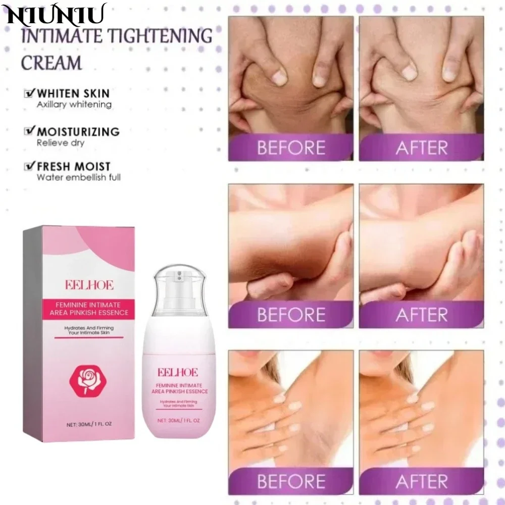 Women Armpit Lightening Cream Brightening Body Bleaching Cream Hand Knuckles Private Parts Brightening Emulsion Korean Skin Care