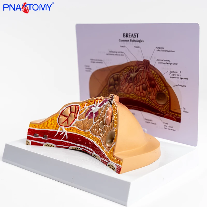 Breast Anatomy Model Teaching Aids Female Breast Structure Medical Beauty Salon Props Pathology Breast Dissection Teaching Gift