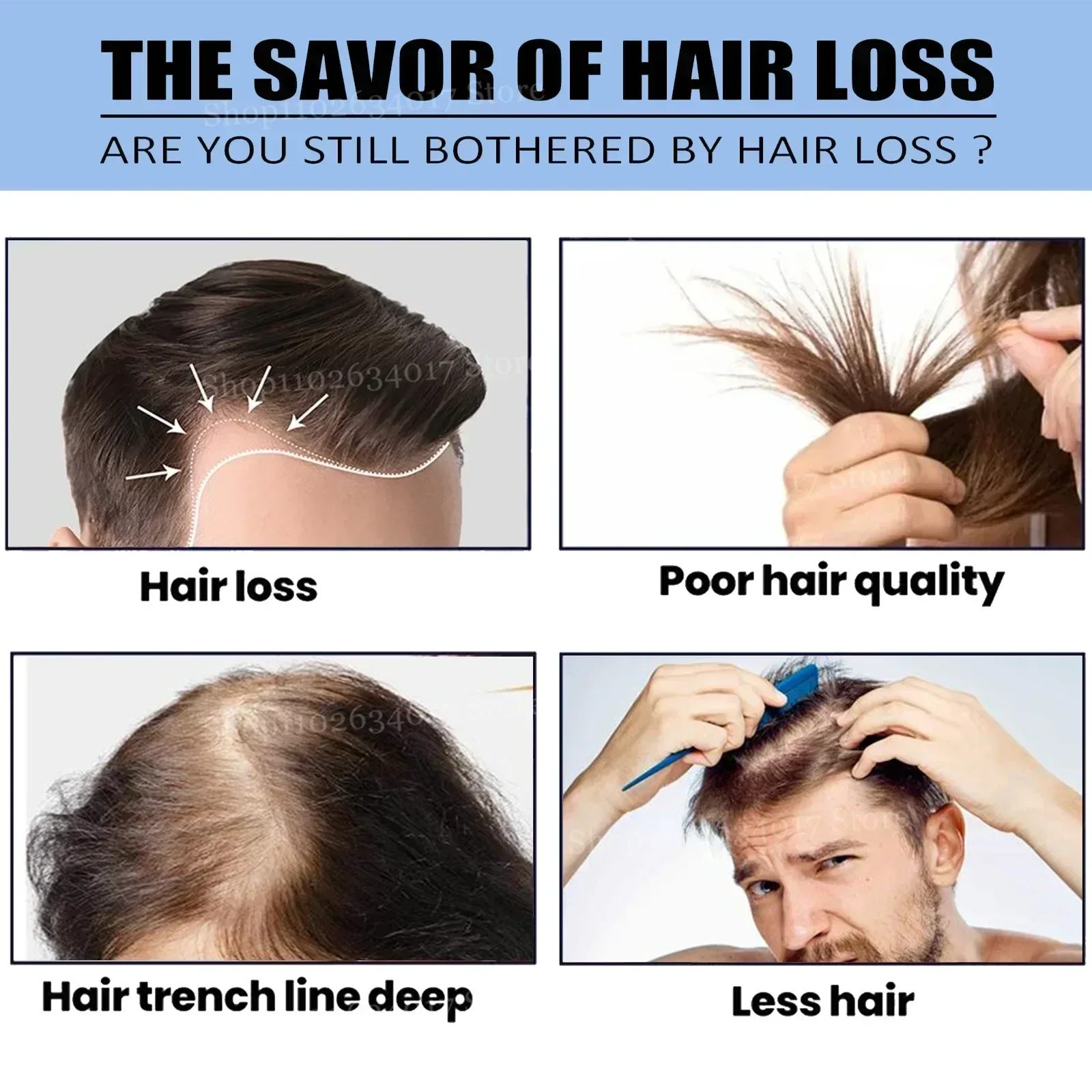1ST Strengt Hair Nourishes Scalp Light Weight Non Greasy Improve Scalp Circulation Hair Growth Essential Loss Regrowth Treatment