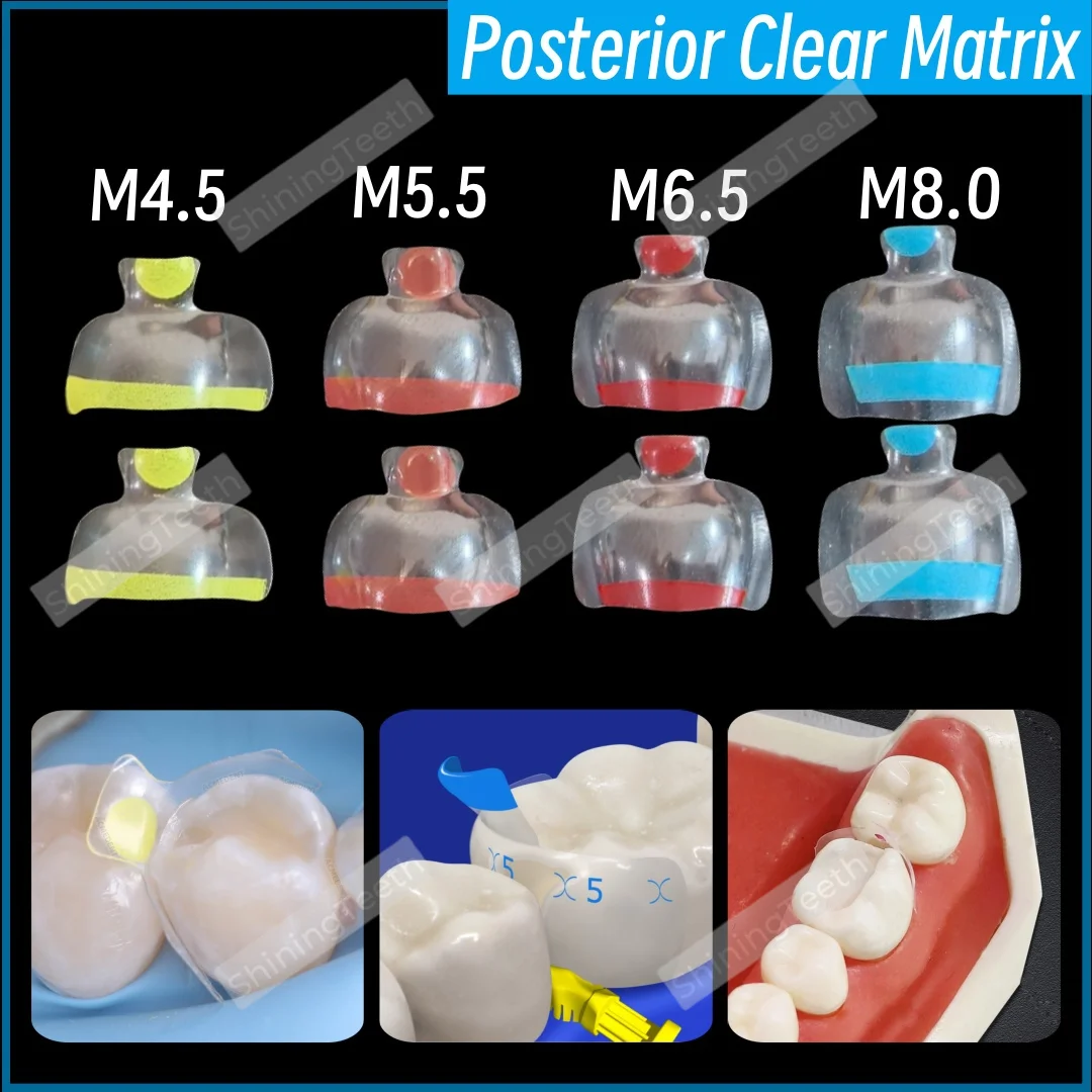 

5Pcs Dental Transparent Clear Matrix Posterior Restorative BT Bow Maxillary Matrices Fit BioClear M4.5/M5.5/M6.5/M8.0 ﻿