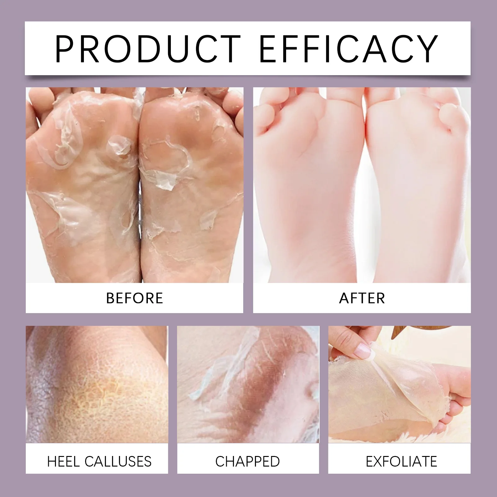 Lavender Exfoliating Foot Mask,Gentle Milk Acid Exfoliation Zero Irritation,Collagen Plumping For Youthful,Smooth Feet,Shea Butter No Post Peel Dryness,Restores Soft Baby Feet,3D Leak Proof, Wearable Design,Aromatherapy Lavender For Bedtime Self-Care
