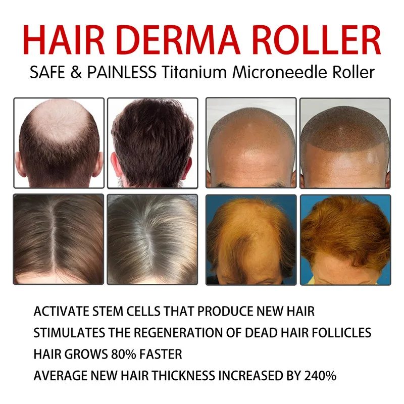 Natural homem barba crescimento derma rolo drs 540 micro agulha dermaroller recrescimento do cabelo anti tratamento de perda de cabelo 0.2/0.25/0.3mm