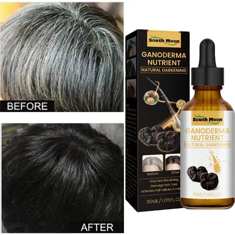 Gray White Hair Treatment Serum Liquid White To Black Natural Color Repair Nourish Product Anti Loss Hair Care Men Women