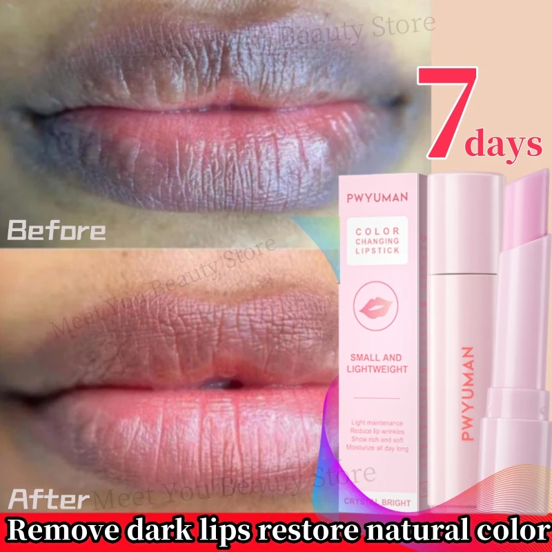 

Whiten Remove Dark Lip Balm Deep Moisturize Lighten Melanin Mask Gloss Oil Exfoliate Nourish Fade Lip Line Korean Sleep Lipstick