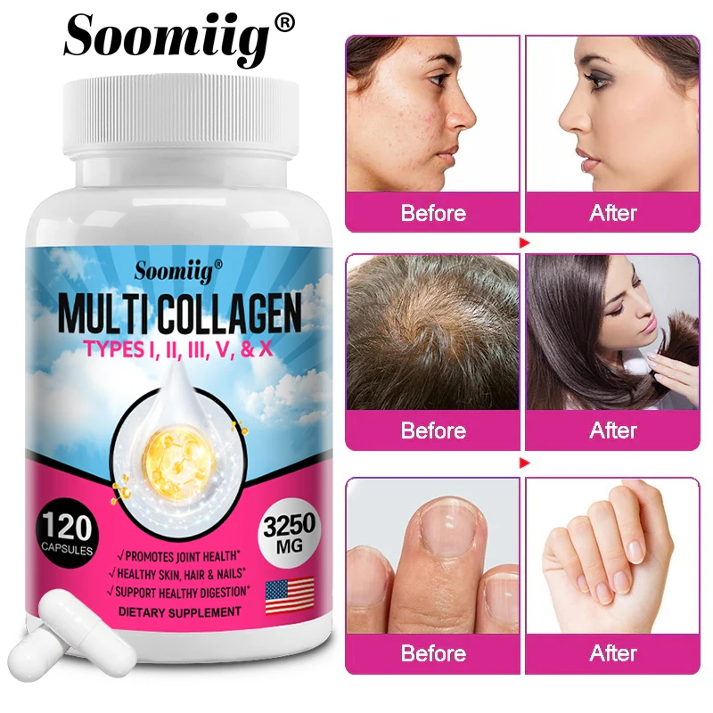 Multi-Collagen TYPES I, II, III, V, & X, Hyaluronic Acid, Vitamin C & Biotin Marine Collagen Capsules - Skin Nails Hair Joints