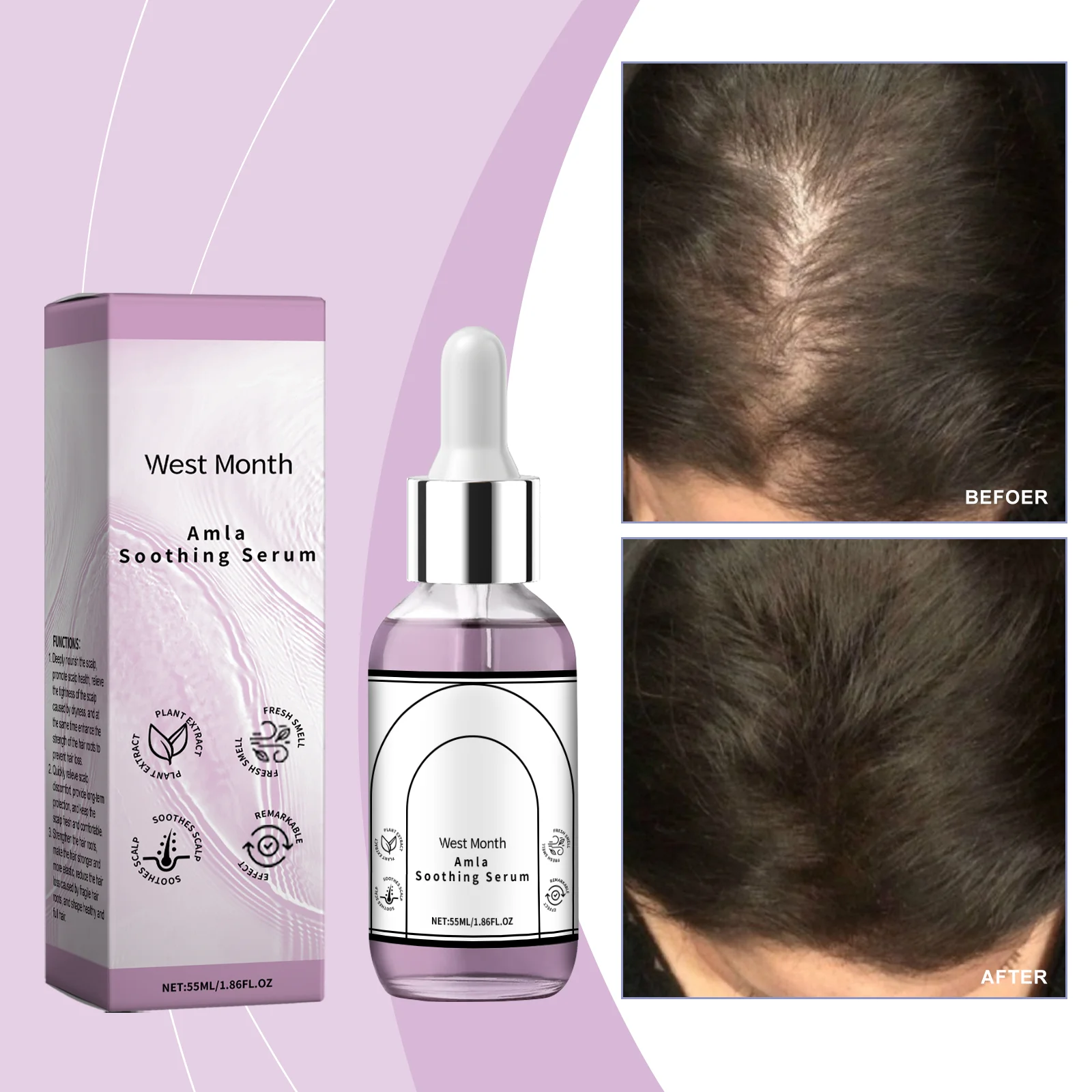 

Soothing Scalp Serum Hair Growth Anti-Hair Loss Oil Repair Damaged Follicles Deeply Nourishes Sooth Scalp Hair Thicken Hair Care