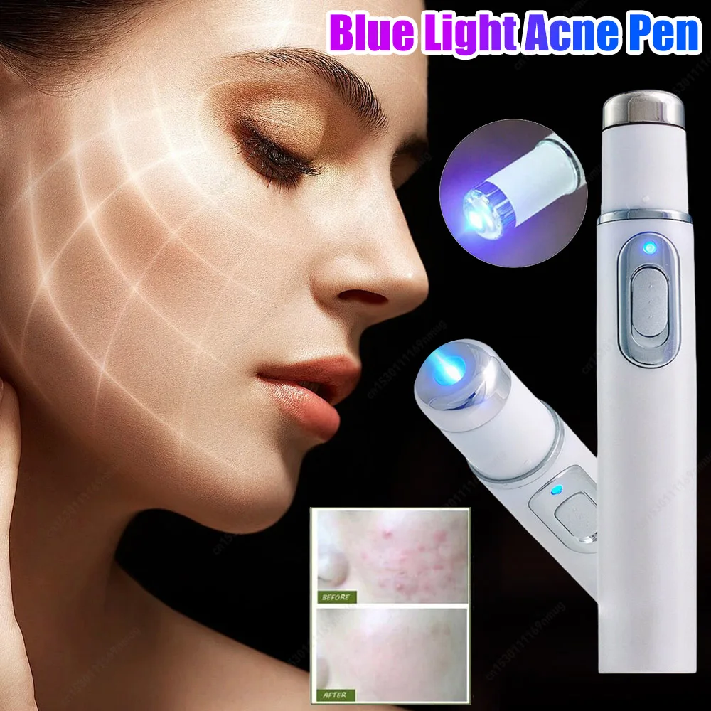 美顔器 アイマッサージャー ブルーライト 黒目の下のクマ フェイシャルケアツール 美白 テクスチャー維持 目袋