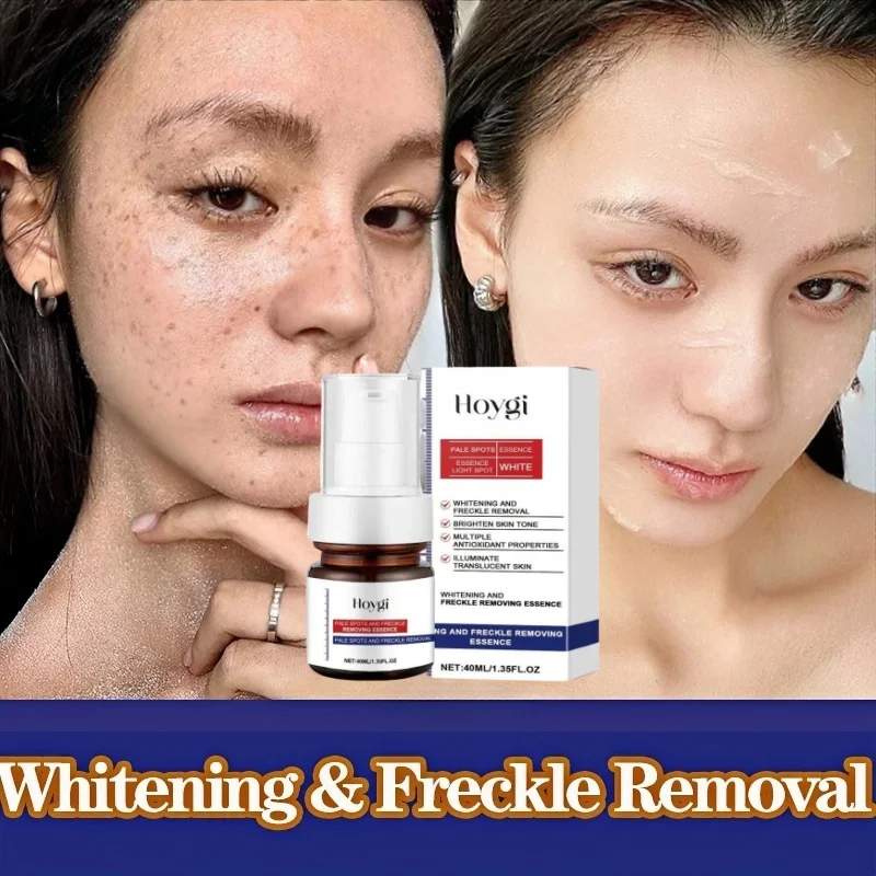 

Powerful Spot-removing Whiten Serum Cream Vitamin C Skin Brighten Essence Removal Melasma Dark Spots Moisturize Beauty Skin Care