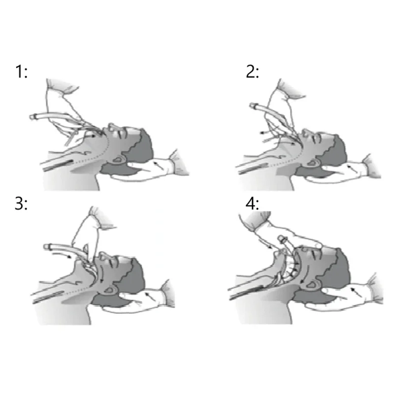 Double Lumen Silicone Reinforced Laryngeal Mask Airway Disposable High Quality LMA Size 3.0 / 4.0 Wholesale