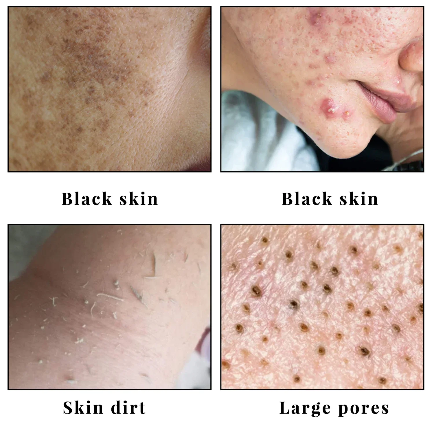 KoJic-ハンドホワイトニングソープ,明るい製品,メラニン,変形,黒点の除去,肌のトーンを改善