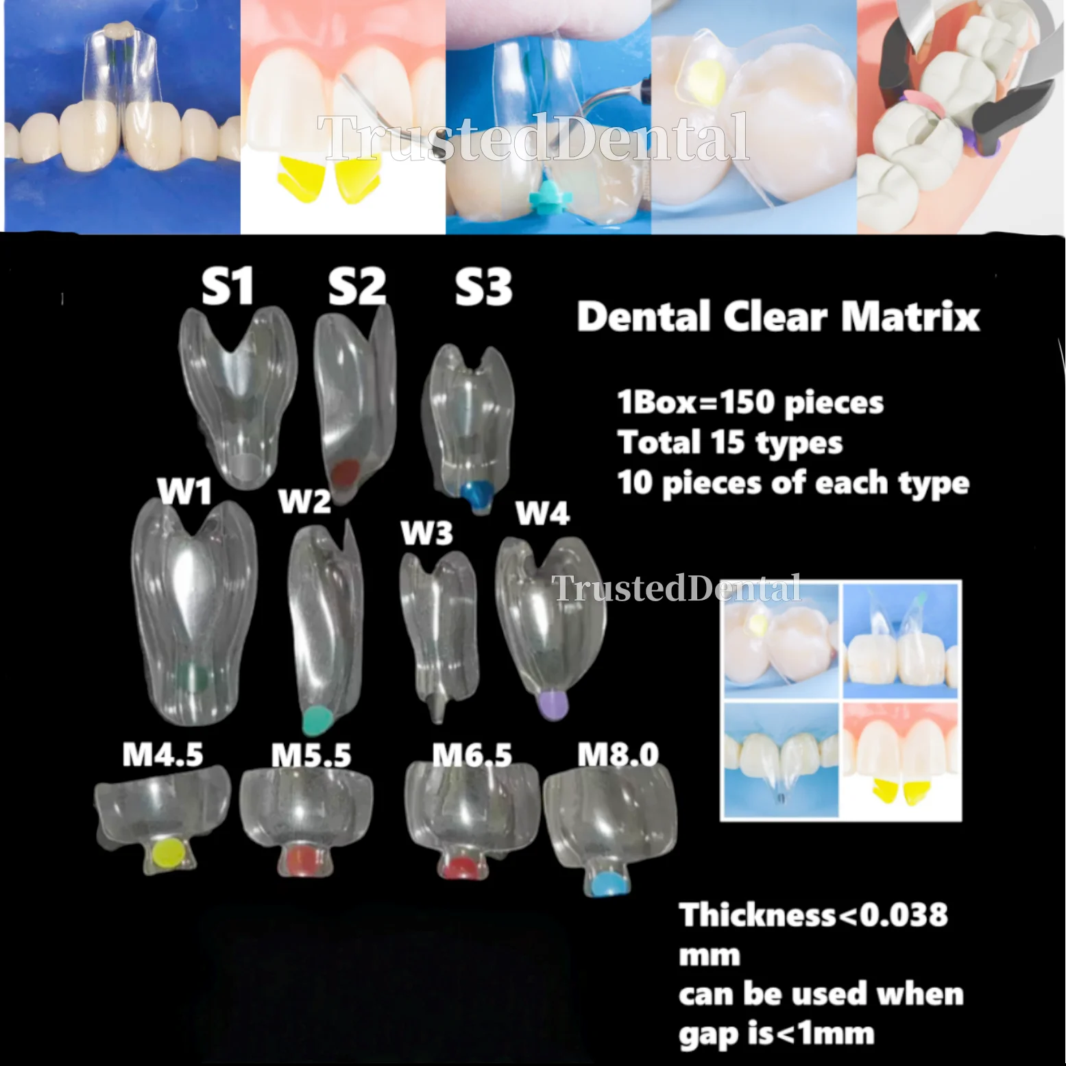 

5 шт., стоматологические прозрачные матрицы, прозрачные матрицы с застежкой BT, клинья диастемы, аналогичные с биопрозрачной диастемой, восстановление класса