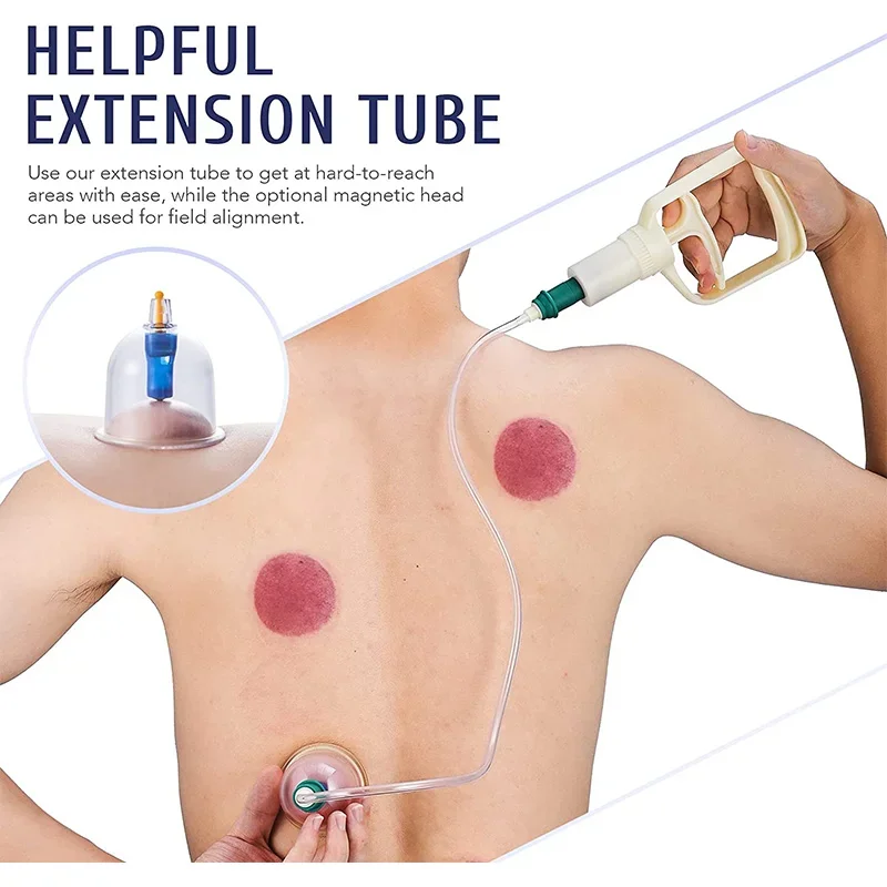 Tuhopeta 6/12/24 Pieces Suction Cups Massage Vacuum Cupping Body Massager Plastic Vacuum Suction Therapy Cupping Set Cans
