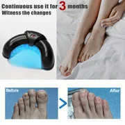 

1/2/4 Pcs Nail Fungus Light Device for Multiple Fingernails & Toenails