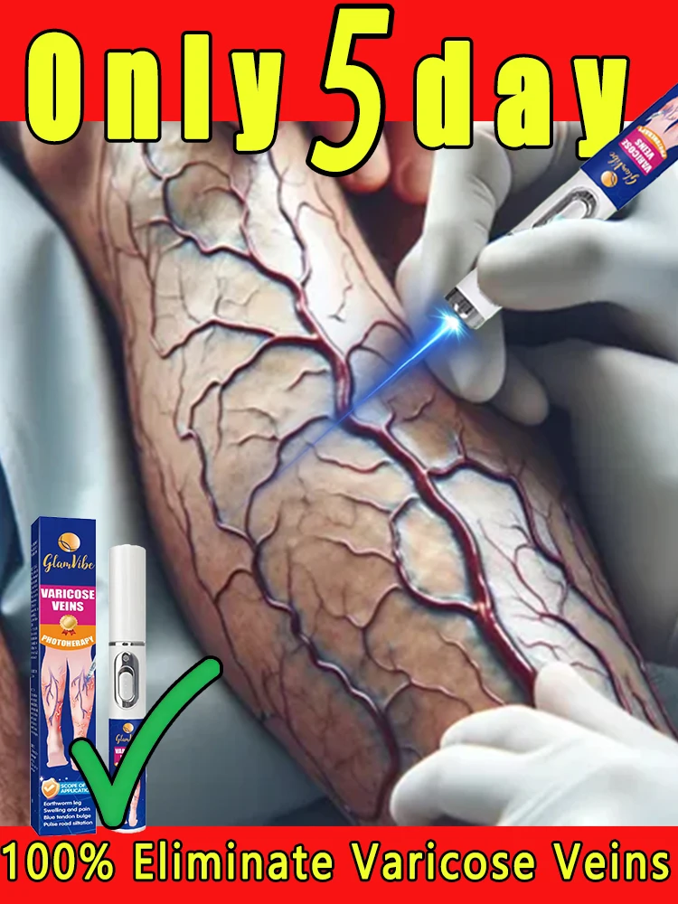 

Vᴀʀɪᴄᴏsᴇ Vᴇɪɴs Tʀᴇᴀᴛᴍᴇɴᴛ Pᴀɪɴ Rᴇʟɪᴇғ & Iᴍᴘʀᴏᴠᴇ Bʟᴏᴏᴅ Cɪʀᴄᴜʟᴀᴛɪᴏɴ Hᴏᴍᴇ Usᴇ