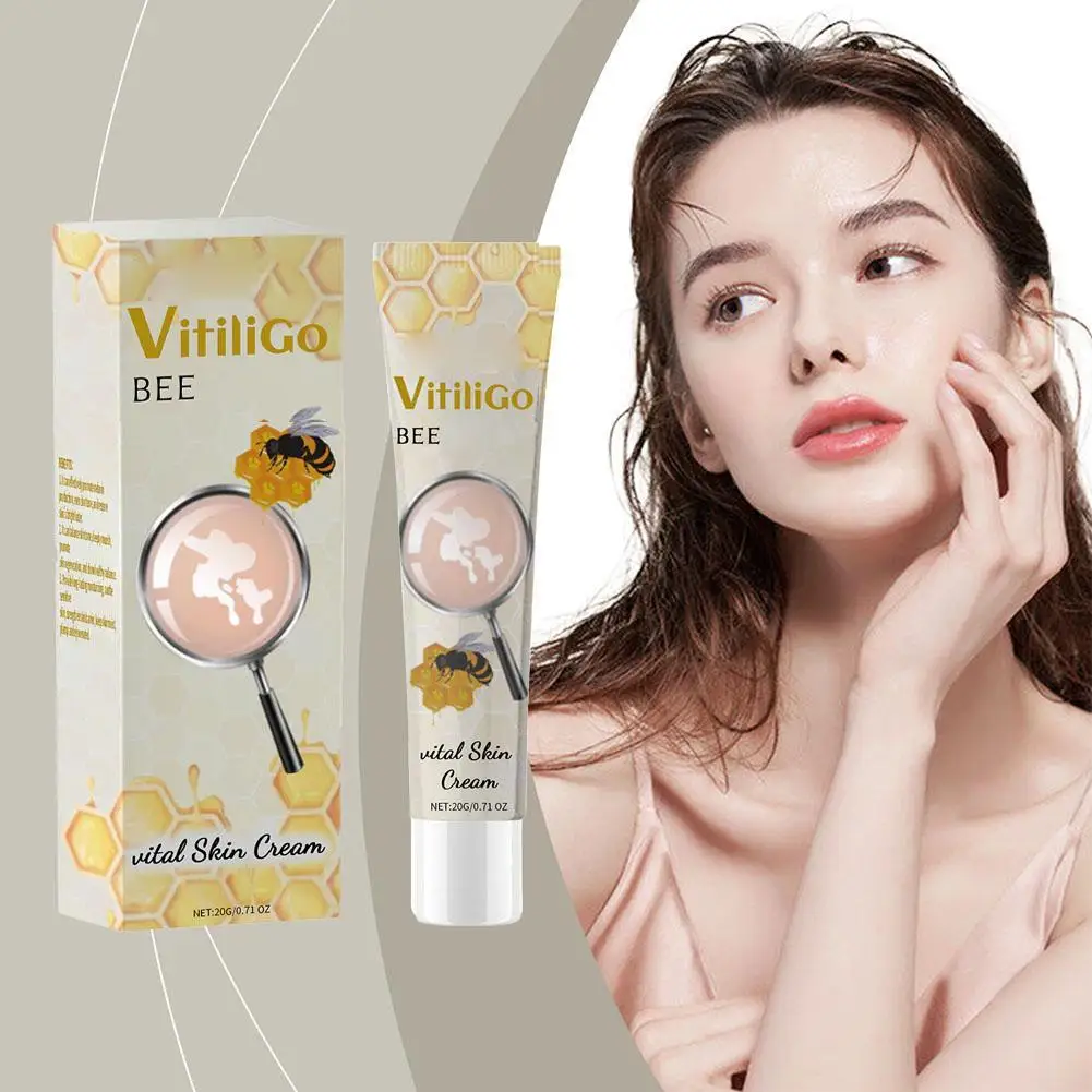 Crème éclaircissante vitale pour la peau, élimine les taches de rousseur, les taches foncées Melasma, éclaircit, dissolvant de taches blanches, 20g