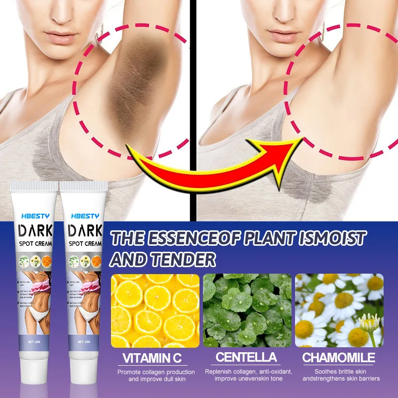 كريم تبييض الأجزاء الخاصة تحت الإبط مصل تبييض تبييض بعقب الركبة سطع الفخذ الداخلي الأجزاء الحميمة إزالة الميلانين الداكن