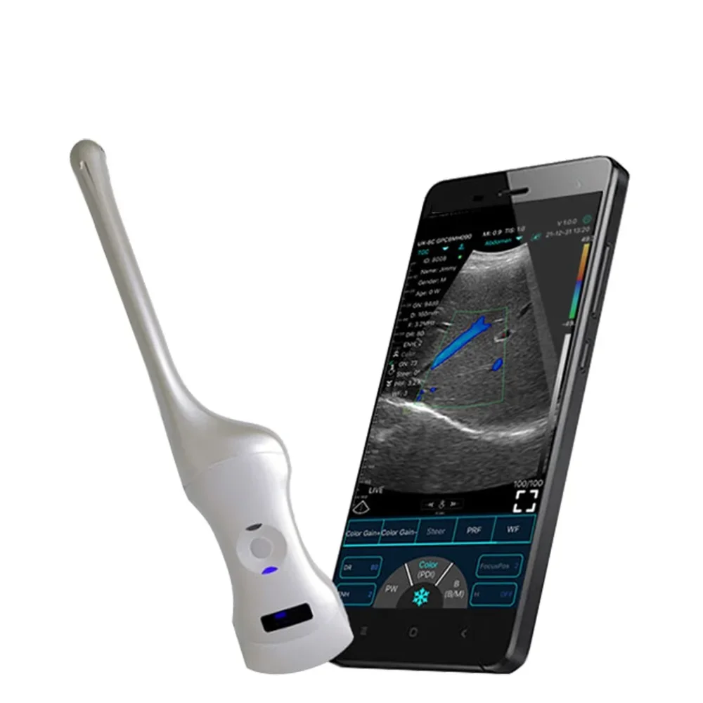 192E Dual-Probes Multipurpose Ultrasound Convex + Endocavity +Cardiac Probe Check Cervicitis Gynecitis Diseases for Female