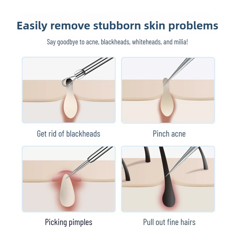 Abrazadera para células, abrazadera para espinillas, abrazadera de precisión, pinzas ultrafinas, Extractor de puntos negros, aguja para acné, limpiador Facial, herramienta para el cuidado de la piel