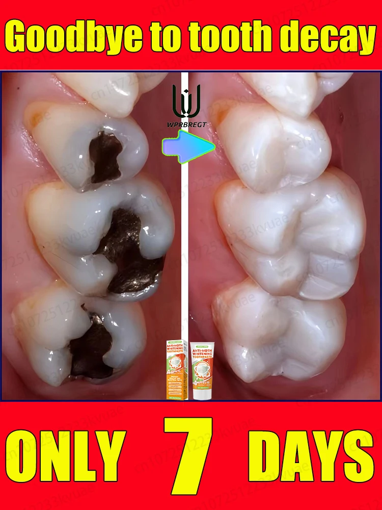 Repair cavities Protect teeth Prevent cavities