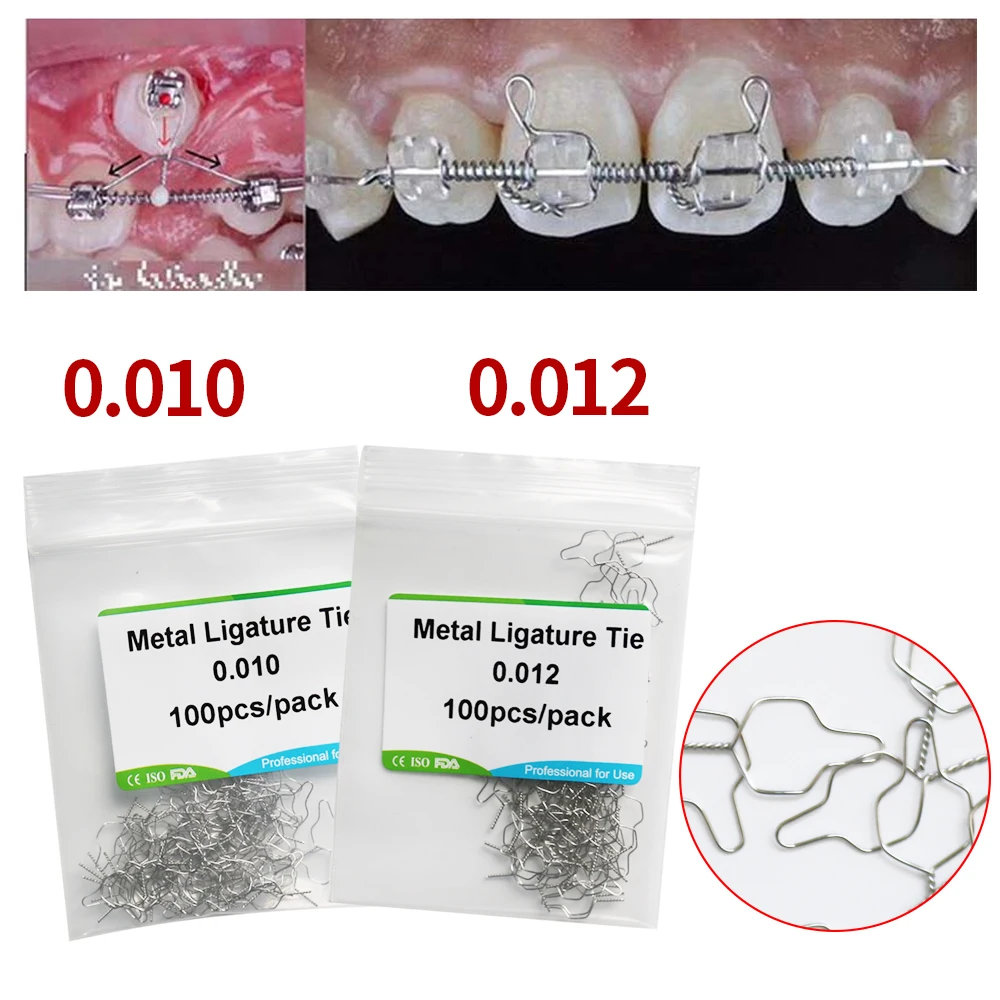 100Pcs/Lot Stainless Steel Preformed Liga-ture Ties Twisted End Dentist Lab Materials Products