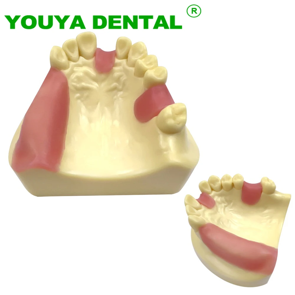 

Dental Implant Practice Model Dentistry Study Teaching Teeth Jaw Typodont Model Dentist Education Training Demonstration Tools