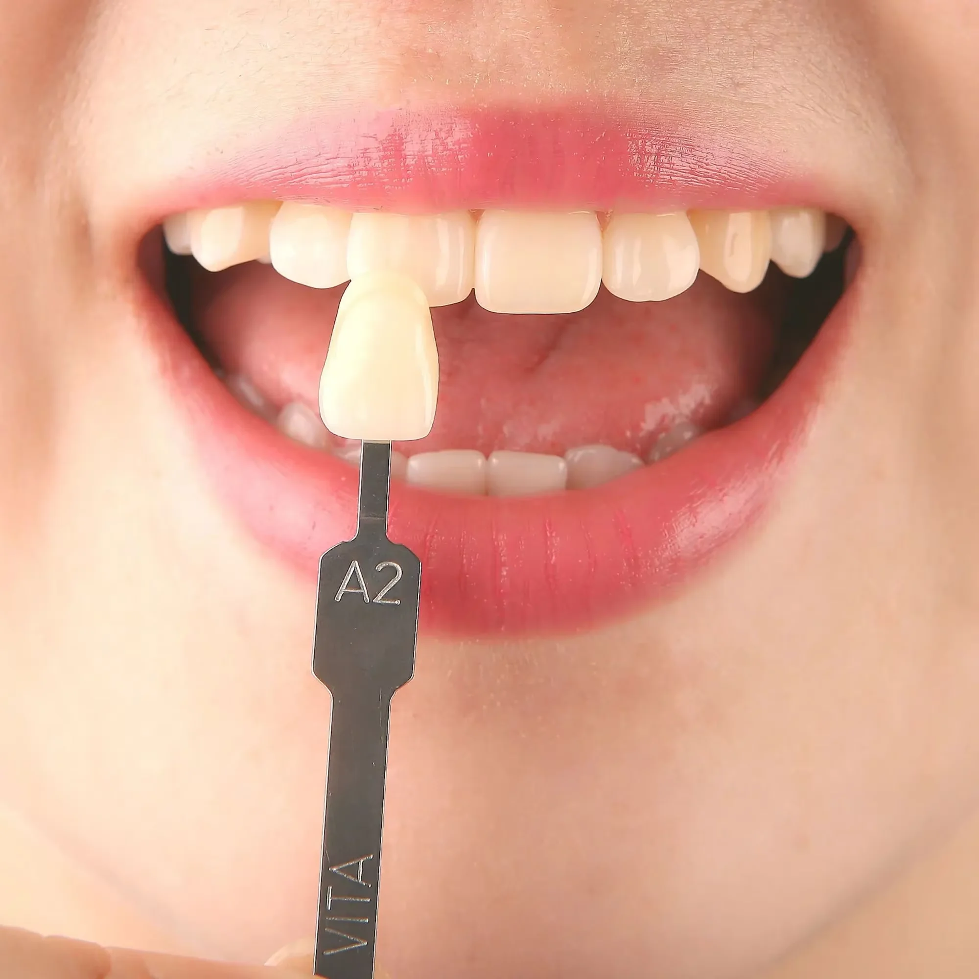 VITA 16 Colors Dental Teeth Sh - Teeth Whitening Shade Guide review and price