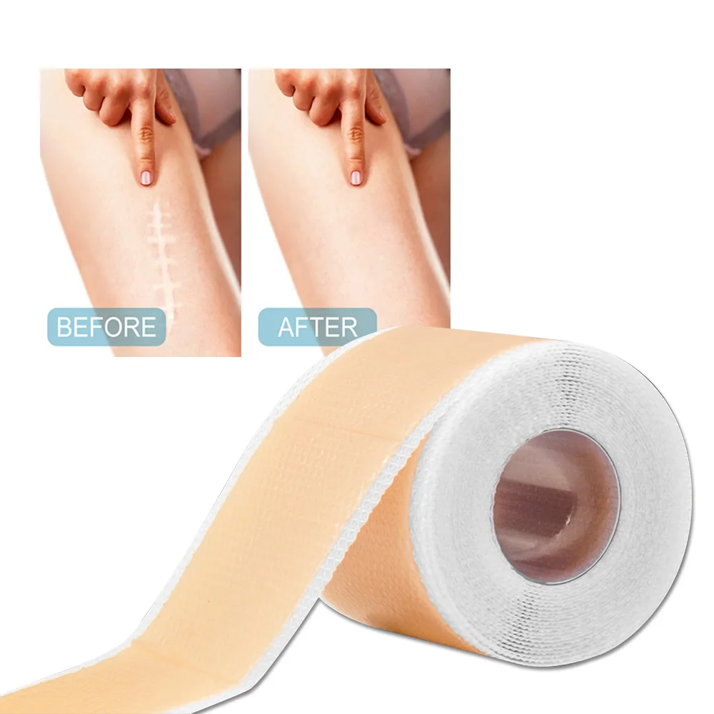 Remoção de cirurgia de silicone gel cicatriz folhas remendo de reparo da pele auto-adesivo estiramento marca fita queimar acne cicatriz cuidados com a