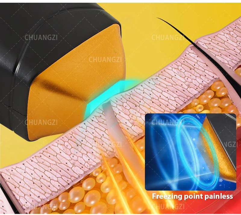 

Portable High Power Ice Cooling Triple Laser 755 808 1064 Device Diode Laser 3 Wavelength Painless 808nm Hair Removal Machine