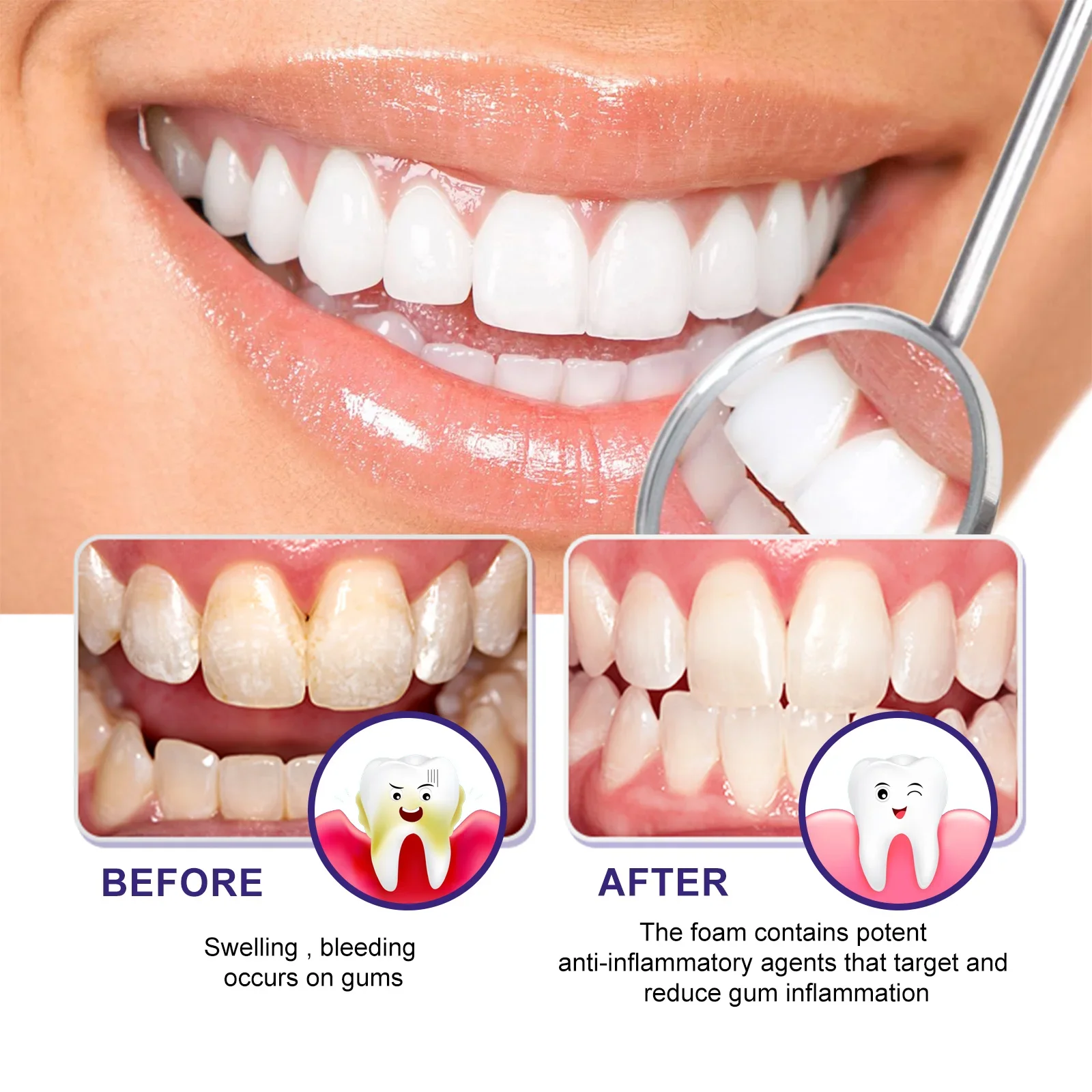 2 pçs creme dental espuma mousse dentes limpeza profunda dentes amarelos sujeira remove manchas de dentes oral hálito fresco dentes e cuidados com as gengivas