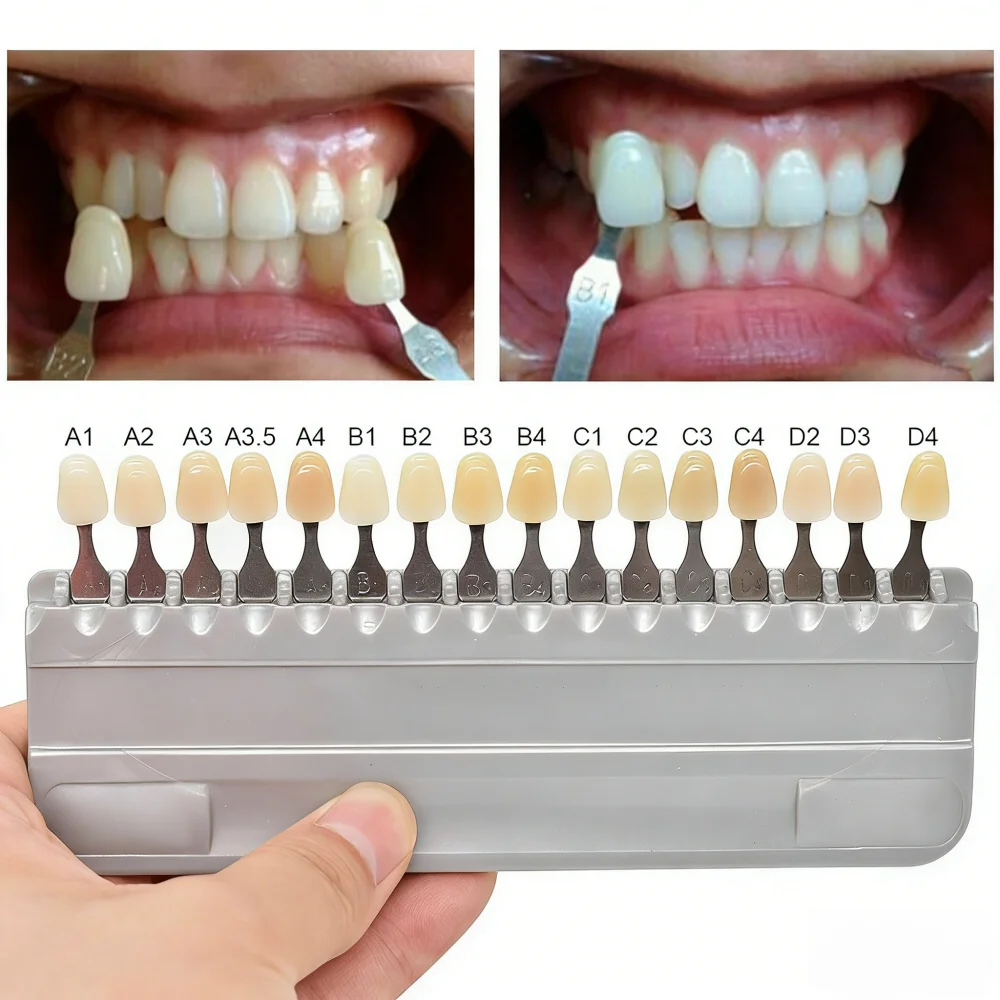 VITA 16/29 Colors Teeth Shade Guide Dentistry Equipment Teeth Whiting Porcelain VITAPAN Tooth Model Colorimetric Plate