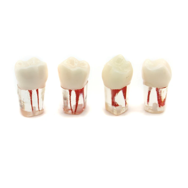 4PCS Dental Tooth Model Endodontic Root Canal Block RCT Practice Pulp Cavity Dentistry Replace Resin Teeth Endo Training Tools