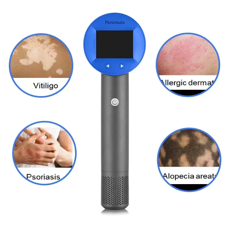 

Peninsula Medical UVB 308nm-311nm LED Phototherapy Excimer Device For Vitiligo Treatment At Home Use