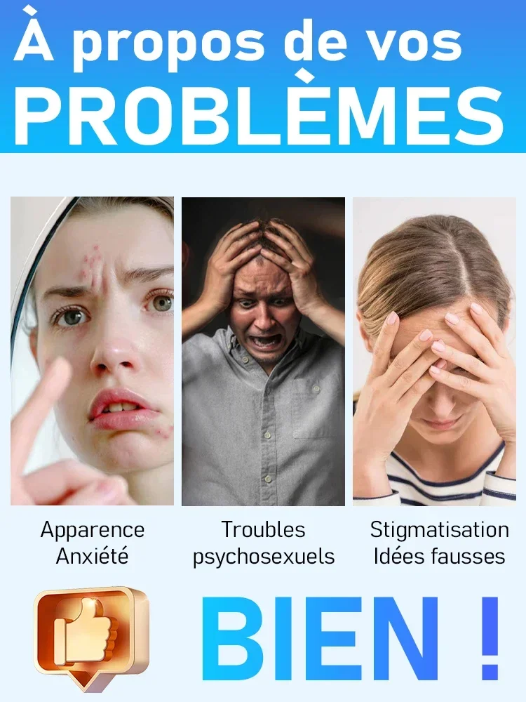 blauw licht pen los wratten op, hete verkoop wrattenverzorgingstools