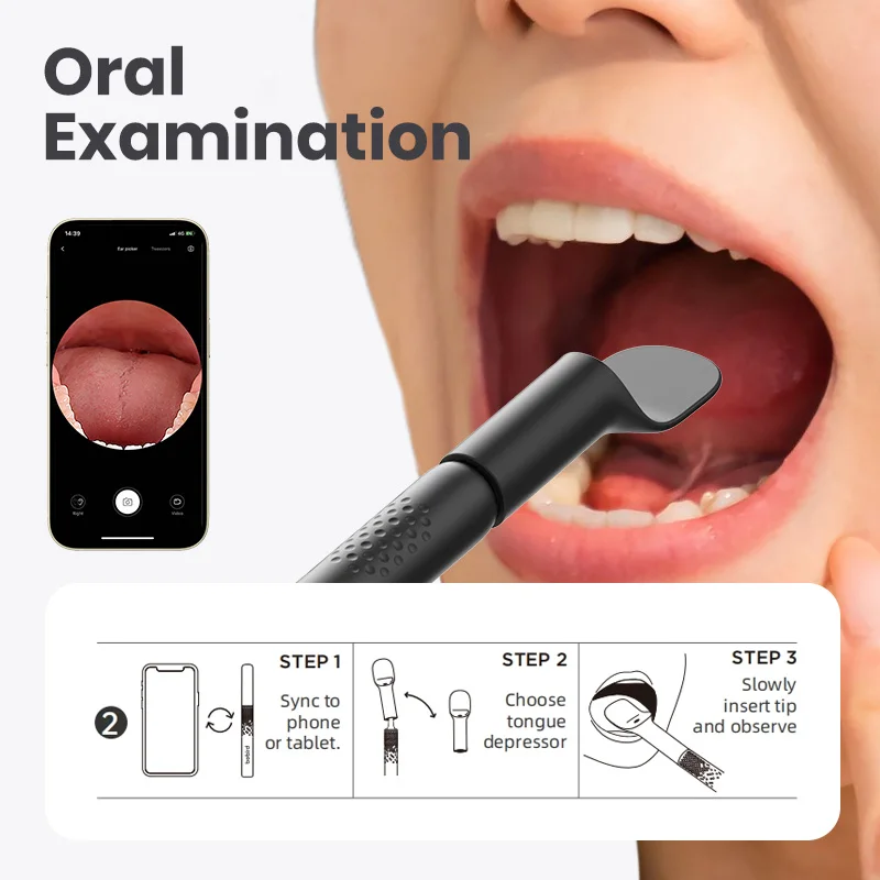 2024 New Arrival-Bebird ENT Observation Kit Set (Not Include Camera Device）For Visual Ear Canal / Nasal / Oral Inspection