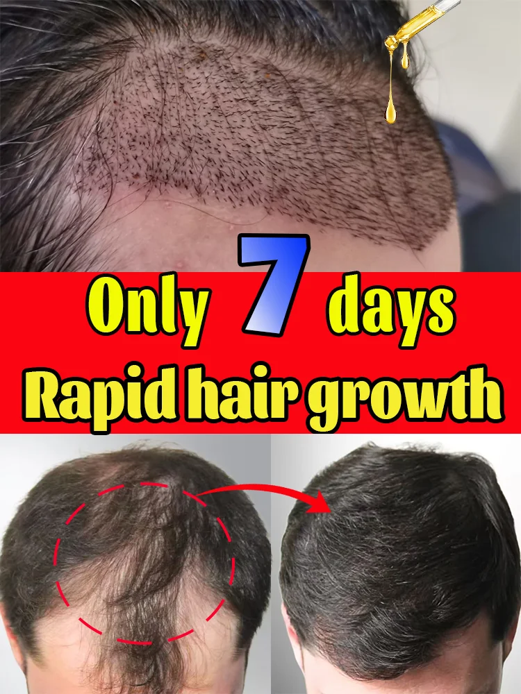 

Мои морщины выцветшие